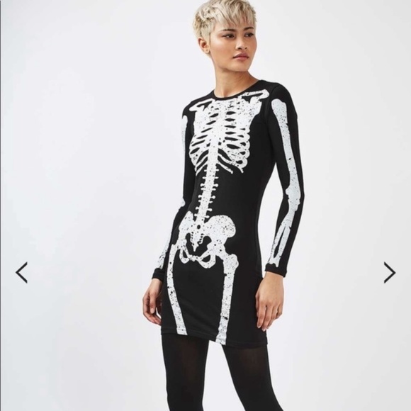 Topshop Black and White Skeleton Mini Dress - Picture 3 of 7